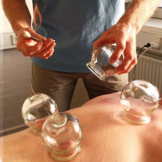 Cupping-massage er en effektiv behandling.